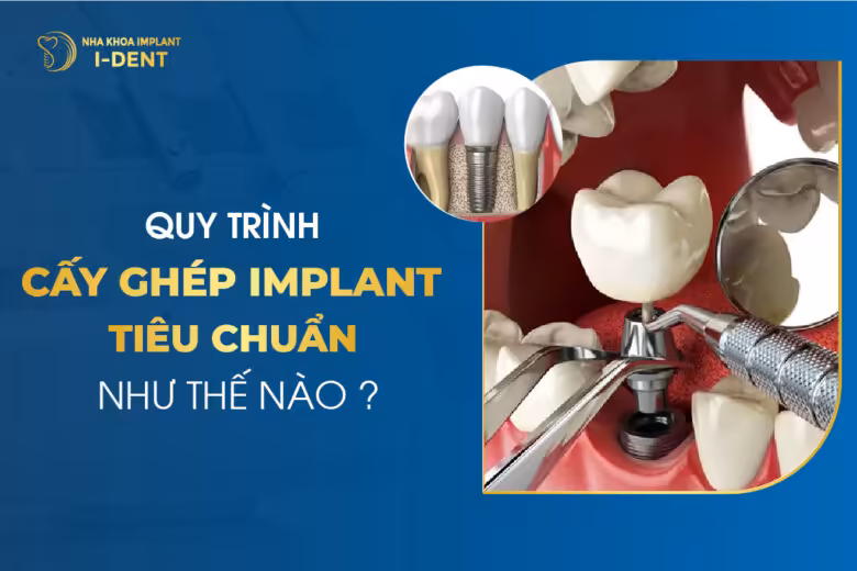 quy trình trồng răng implant
