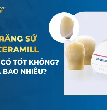 Răng sứ ceramill là gì? Có tốt không? Giá bao nhiêu?