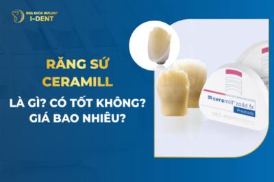 Răng sứ ceramill là gì? Có tốt không? Giá bao nhiêu?