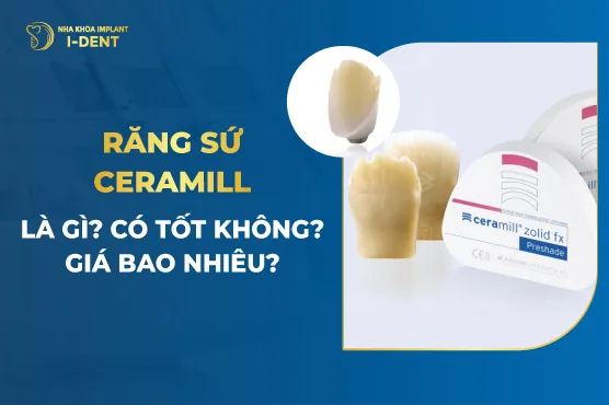 Răng sứ ceramill là gì? Có tốt không? Giá bao nhiêu?