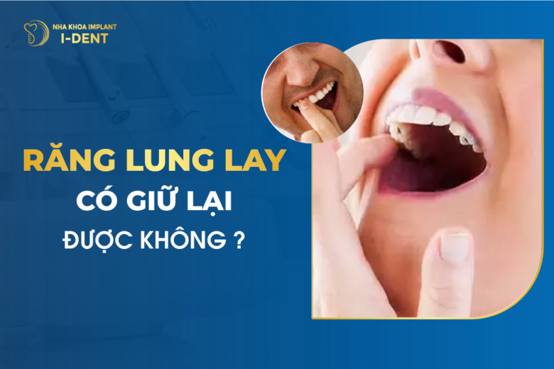 Răng Lung Lay Có Giữ Lại Được Không?
