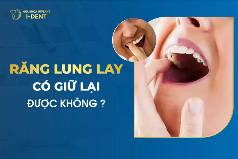 Răng Lung Lay Có Giữ Lại Được Không?