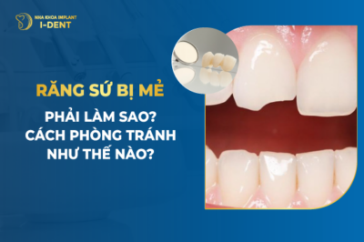 Răng Sứ Bị Mẻ Phải Làm Sao- Cách Phòng Tránh Như Thế Nào-