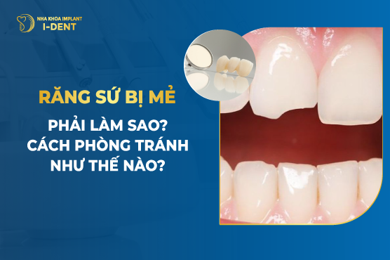 Làm cách nào để chữa trị răng sứ bị mẻ?