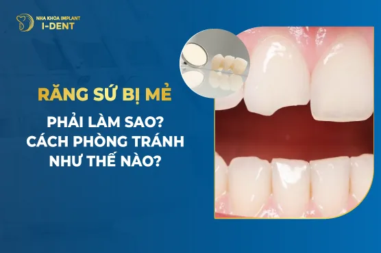 Răng Sứ Bị Mẻ Phải Làm Sao- Cách Phòng Tránh Như Thế Nào-