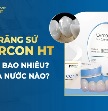 Răng Sứ Cercon HT Giá Bao Nhiêu? Của Nước Nào?