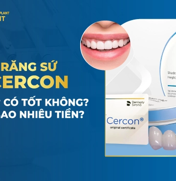 Răng sứ Cercon là gì? Của nước nào? Giá bao nhiêu? Tốt không?