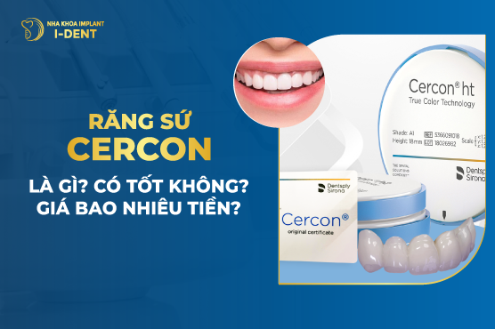 Tìm hiểu về răng sứ cercon có mấy loại và lựa chọn phù hợp