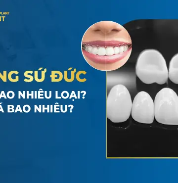 Răng Sứ Đức Có Bao Nhiêu Loại- Giá Bao Nhiêu