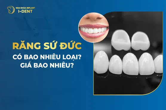 Răng Sứ Đức Có Bao Nhiêu Loại- Giá Bao Nhiêu