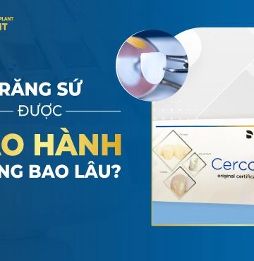 Răng Sứ Được Bảo Hành Trong Bao Lâu-