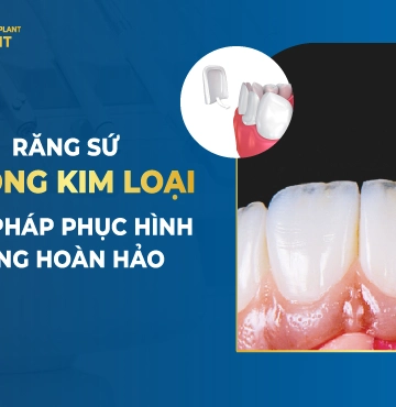 Răng Sứ Không Kim Loại – Giải Pháp Phục Hình Răng Hoàn Hảo