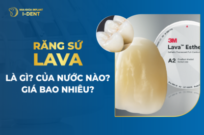 Răng sứ Lava là gì? Của nước nào? Có mấy loại? Tốt không?