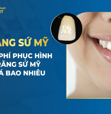 Răng Sứ Mỹ – Chi Phí Phục Hình Răng Sứ Mỹ Giá Bao Nhiêu