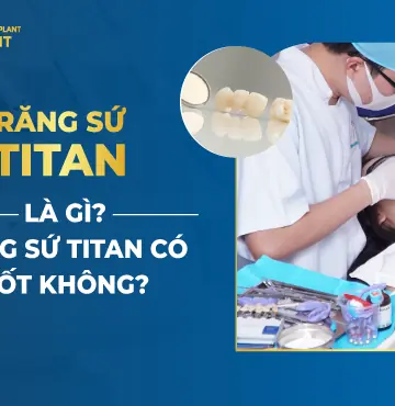 Răng sứ Titan (hay còn gọi là mão sứ Titan) là dòng răng sứ kim loại lâu đời với ưu điểm độ bền cao, khả năng ăn nhai tốt, an toàn, lành tính và giá thành phải chăng.