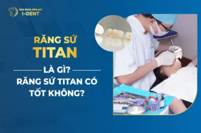 Răng sứ Titan (hay còn gọi là mão sứ Titan) là dòng răng sứ kim loại lâu đời với ưu điểm độ bền cao, khả năng ăn nhai tốt, an toàn, lành tính và giá thành phải chăng.