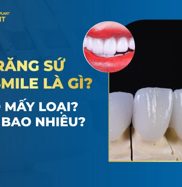Răng Sứ HT Smile Là Gì? Có Mấy Loại? Giá Bao Nhiêu?
