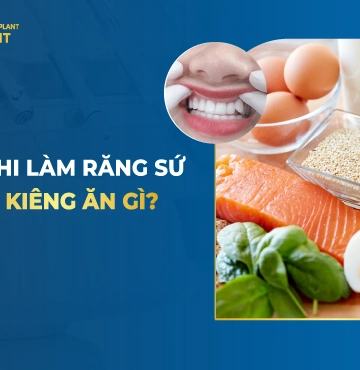 Sau Khi Bọc Răng Sứ Kiêng Ăn Gì? Nên Ăn Gì?