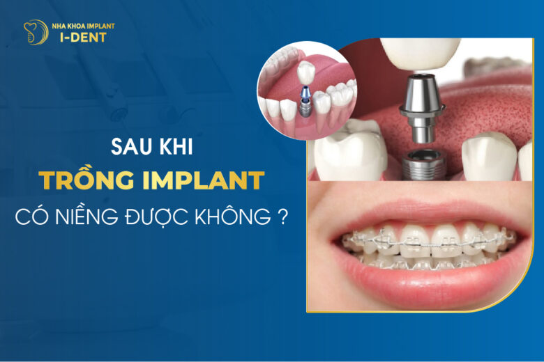 Sau Khi Trồng Implant Có Niềng Được Không?