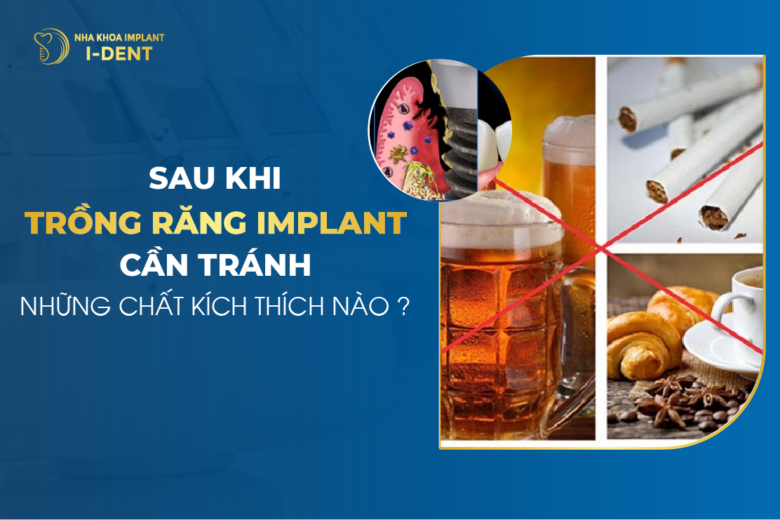 Sau Khi Trồng Răng Implant Cần Tránh Những Chất Kích Thích Nào?