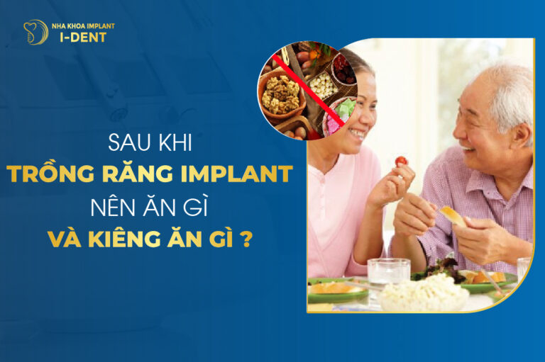 Sau Khi Trồng Răng Implant Nên Ăn Gì Và Kiêng Ăn Gì