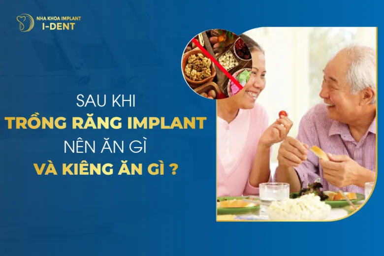 Sau Khi Trồng Răng Implant Nên Ăn Gì Và Kiêng Ăn Gì