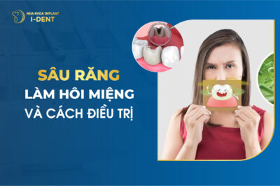 Sâu Răng Làm Hôi Miệng Và Cách Điều Trị