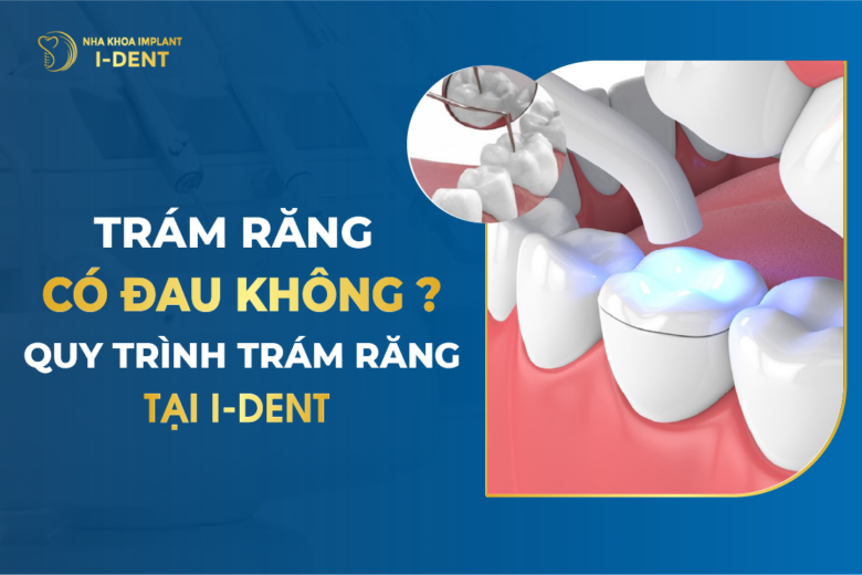 Trám Răng Có Đau Không? Quy Trình Trám Răng Tại I-DENT