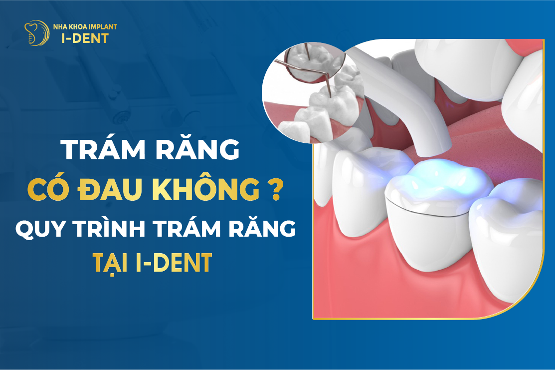 Trám răng có phải là quá trình đau không?