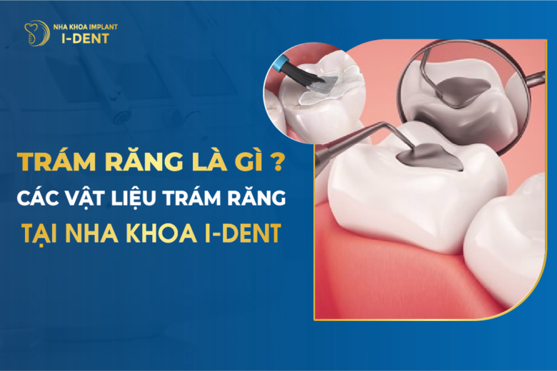Trám Răng Là Gì? Các Vật Liệu Trám Răng Tại Nha Khoa I Dent