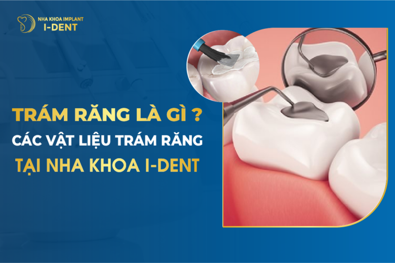 Trám Răng là Gì? Các Vật Liệu Trám Răng Tại Nha khoa I-DENT