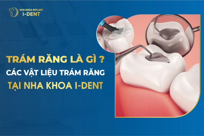 Trám Răng Là Gì? Các Vật Liệu Trám Răng Tại Nha Khoa I-Dent