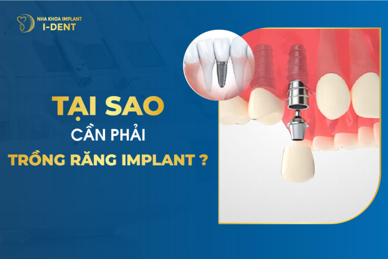 Tại Sao Cần Phải Trồng Răng Implant?