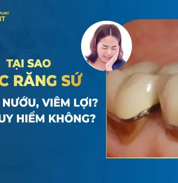bọc răng sứ bị viêm lợi