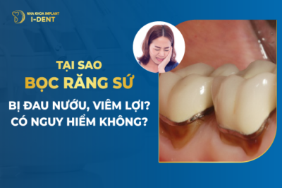 bọc răng sứ bị viêm lợi