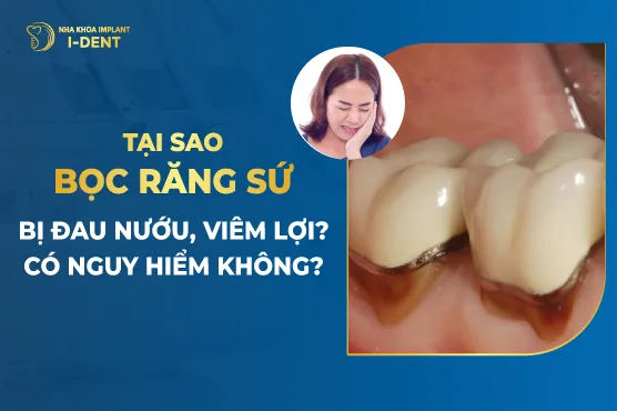 bọc răng sứ bị viêm lợi
