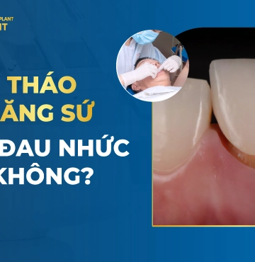 Tháo Răng Sứ Có Đau Nhức Không-