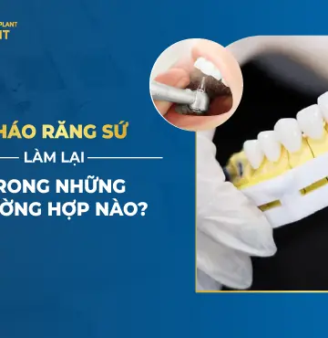 Bọc Răng Sứ Tháo Ra Có Lắp Lại Được Không?