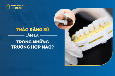 Bọc Răng Sứ Tháo Ra Có Lắp Lại Được Không?