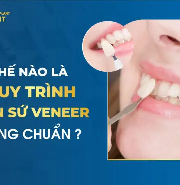Thế Nào Là Quy Trình Dán Răng Sứ Veneer Đúng Chuẩn?