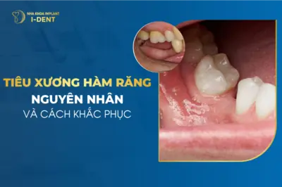 tiêu xương hàm