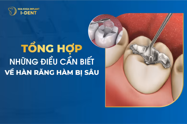 Tổng Hợp Những Điều Cần Biết Về Hàn Răng Hàm Bị Sâu