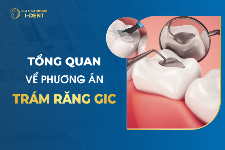 Tổng Quan Về Phương Án Trám Răng GIC