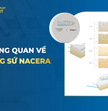 Tổng Quan Về Răng Sứ Nacera