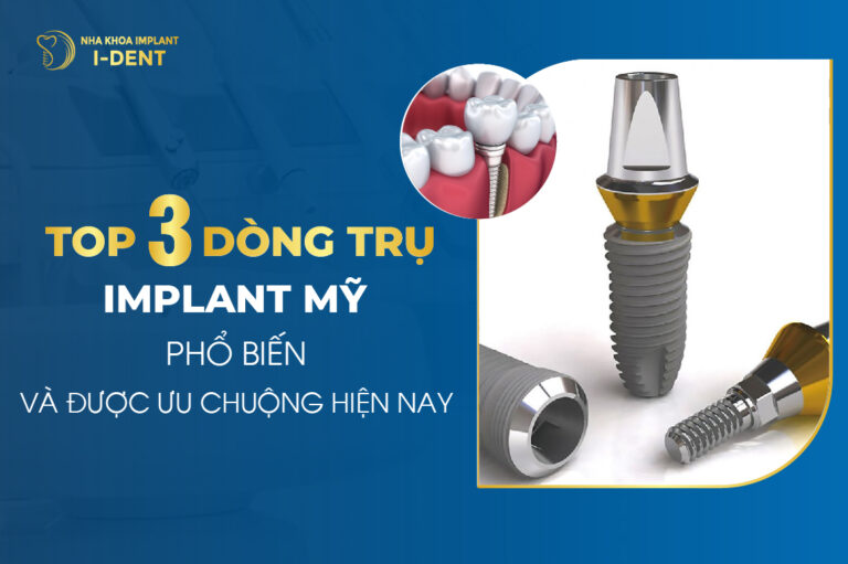 Top 3 Dòng Trụ Implant Mỹ Phổ Biến Và Được Ưa Chuộng Hiện Nay