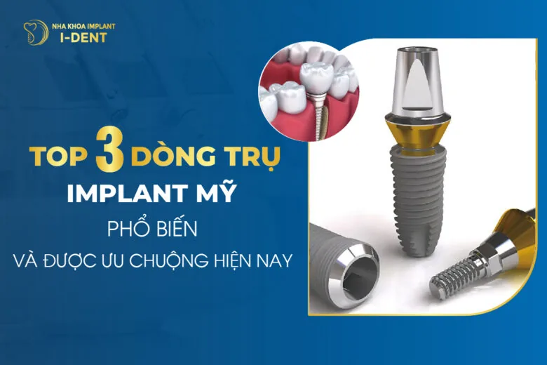 Top 3 Dòng Trụ Implant Mỹ Phổ Biến Và Được Ưa Chuộng Hiện Nay