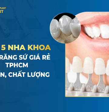 Top 5 Nha Khoa Bọc Răng Sứ Giá Rẻ TPHCM Uy Tín, Chất Lượng