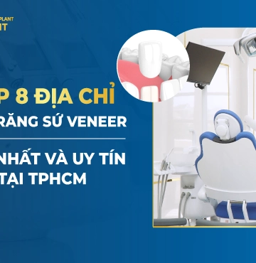 Top 8 Địa Chỉ Dán Răng Sứ Veneer Tốt Nhất Và Uy Tín Tại TPHCM