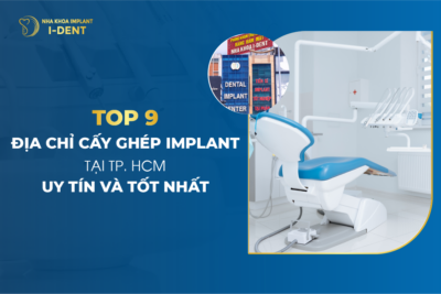 Top 9 Địa chỉ cấy ghép implant tại TPHCM uy tín và tốt nhất