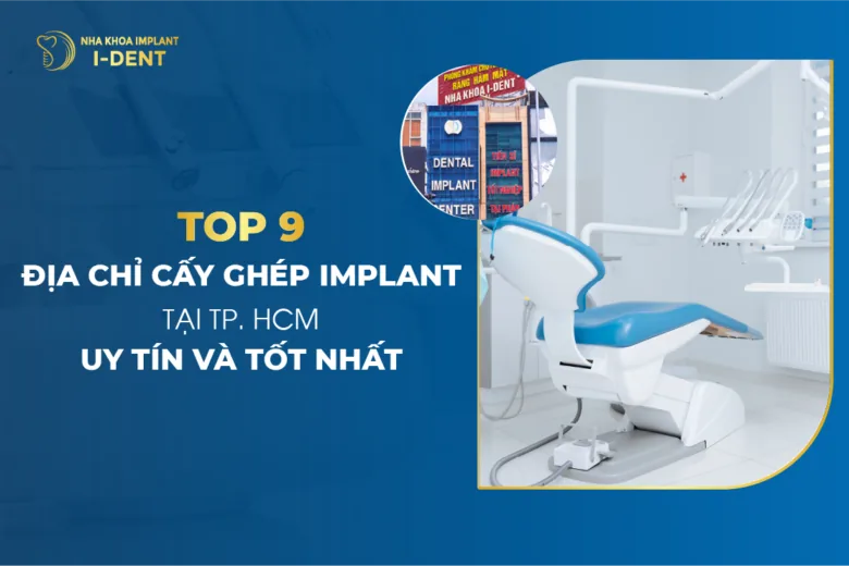 Top 9 Địa chỉ cấy ghép implant tại TPHCM uy tín và tốt nhất
